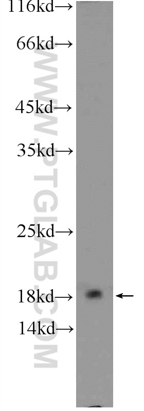 Western Blot (WB) analysis of mouse thymus tissue using ARPC5 Polyclonal antibody (16717-1-AP)