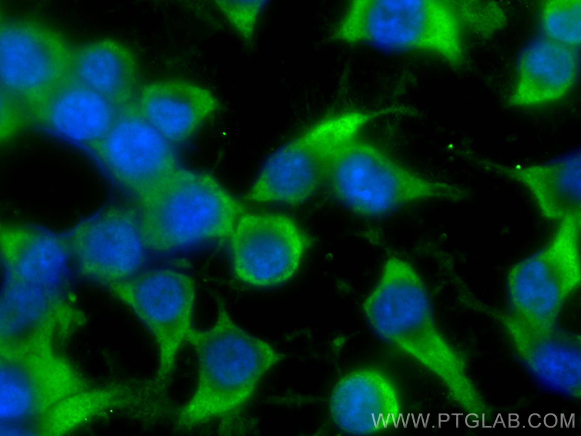 Immunofluorescence (IF) / fluorescent staining of Neuro-2a cells using CoraLite® Plus 488-conjugated ARPC5 Polyclonal ant (CL488-16717)