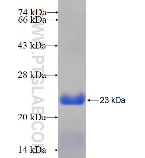 ARPC5 fusion protein Ag9937 SDS-PAGE
