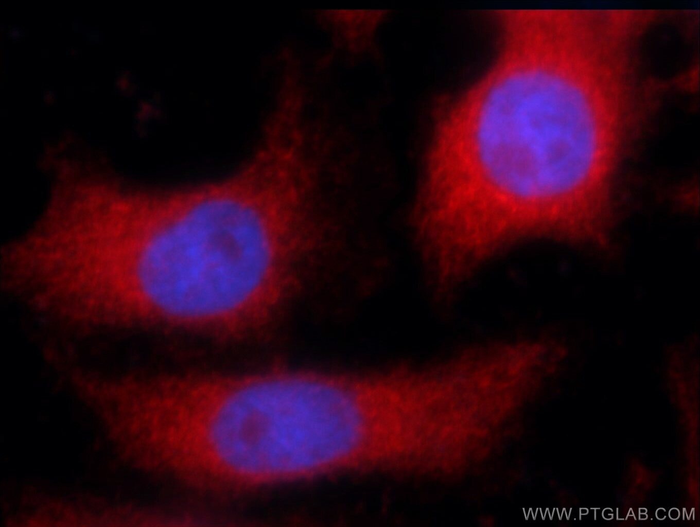 Immunofluorescence (IF) / fluorescent staining of MCF-7 cells using ARPC5L Polyclonal antibody (22025-1-AP)