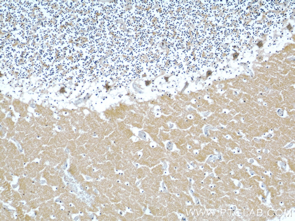Immunohistochemistry (IHC) staining of human cerebellum tissue using ARPC5L Polyclonal antibody (22025-1-AP)
