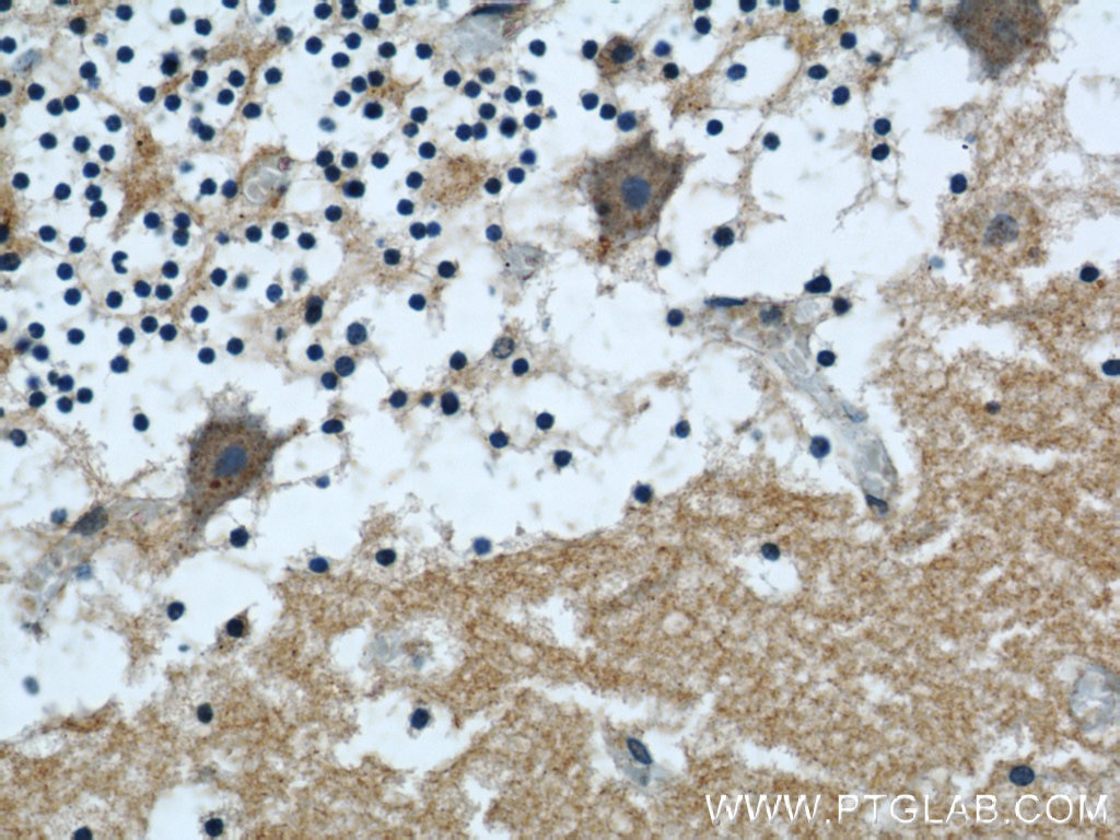 Immunohistochemistry (IHC) staining of human cerebellum tissue using ARPC5L Polyclonal antibody (22025-1-AP)