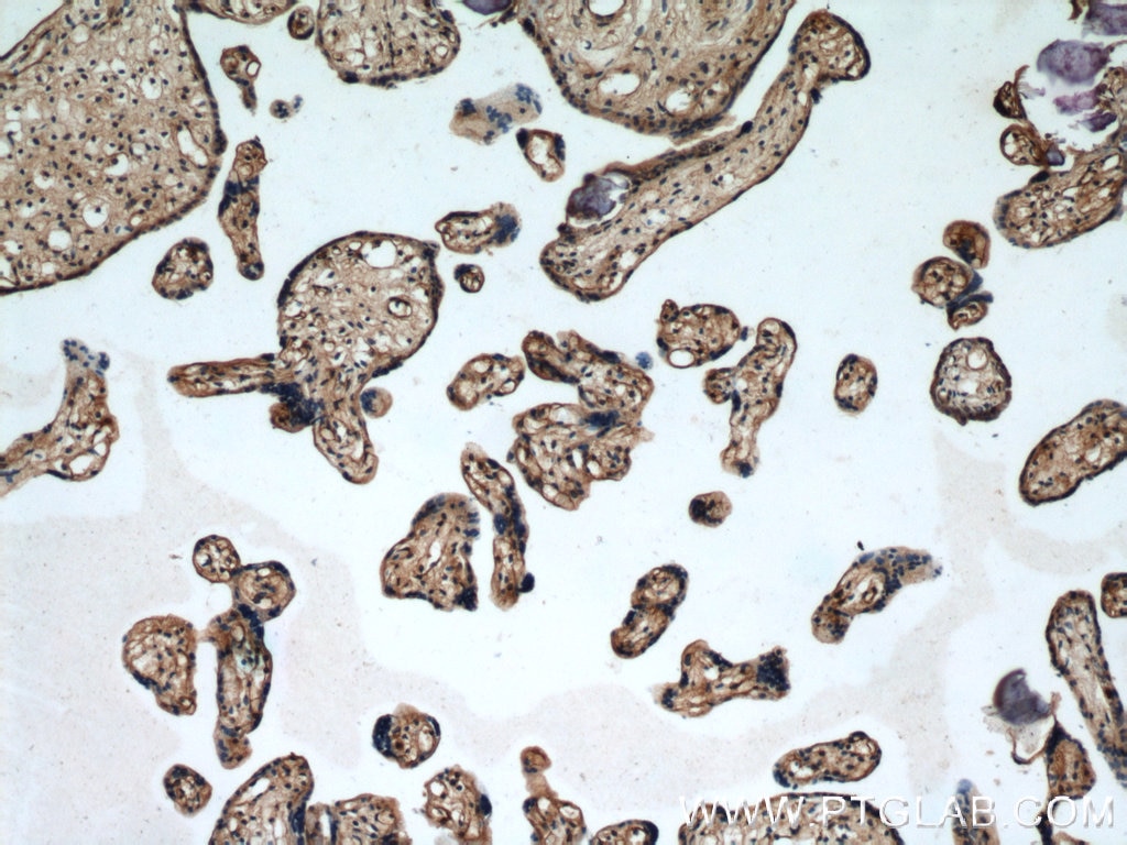 Immunohistochemistry (IHC) staining of human placenta tissue using ARPC5L Polyclonal antibody (22025-1-AP)
