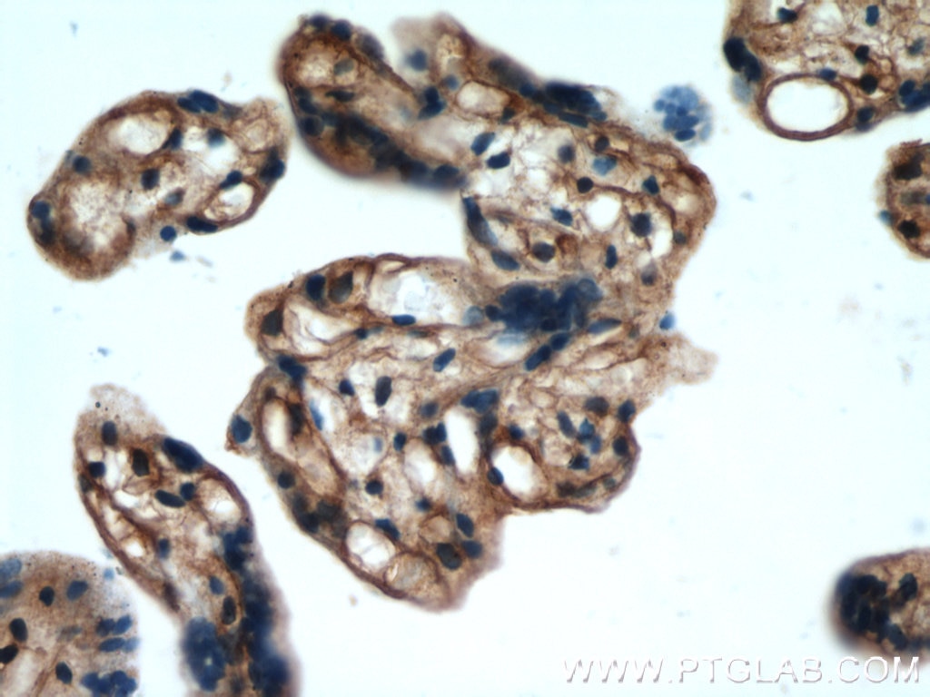 Immunohistochemistry (IHC) staining of human placenta tissue using ARPC5L Polyclonal antibody (22025-1-AP)