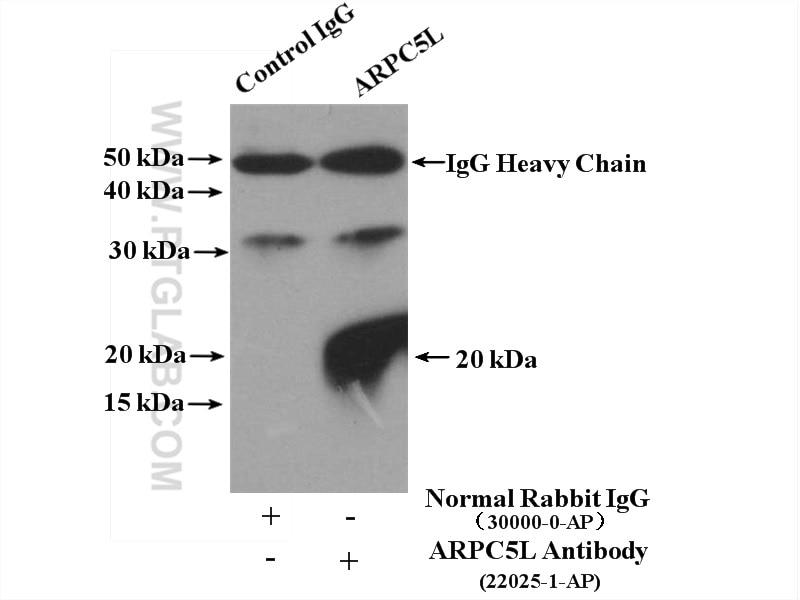 Immunoprecipitation (IP) experiment of mouse brain tissue using ARPC5L Polyclonal antibody (22025-1-AP)