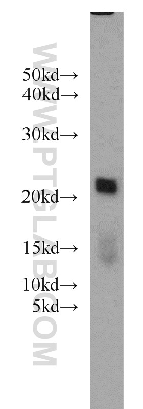 Western Blot (WB) analysis of human brain tissue using ARPC5L Polyclonal antibody (22025-1-AP)