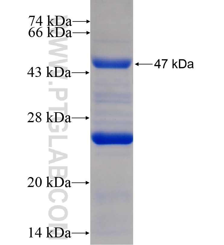 ARPC5L fusion protein Ag16881 SDS-PAGE
