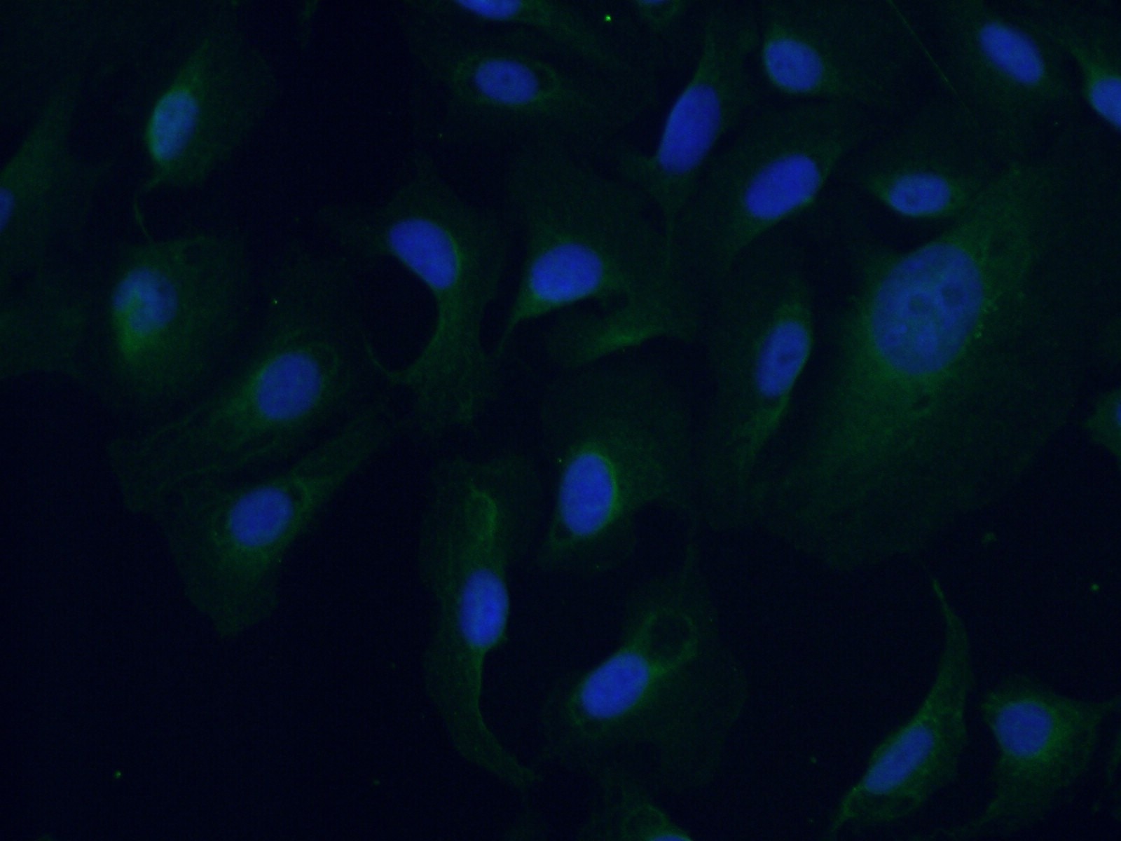 IF Staining of U2OS using 27580-1-AP