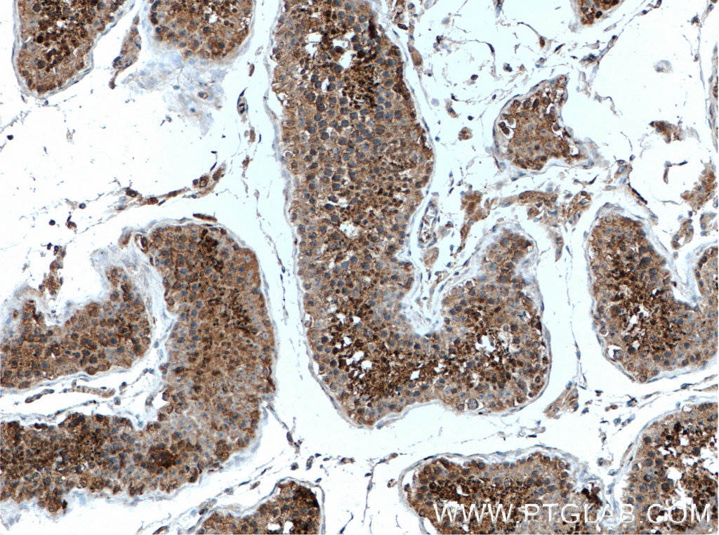 Immunohistochemistry (IHC) staining of human testis tissue using ACTRT3/ARPM1 Polyclonal antibody (27580-1-AP)