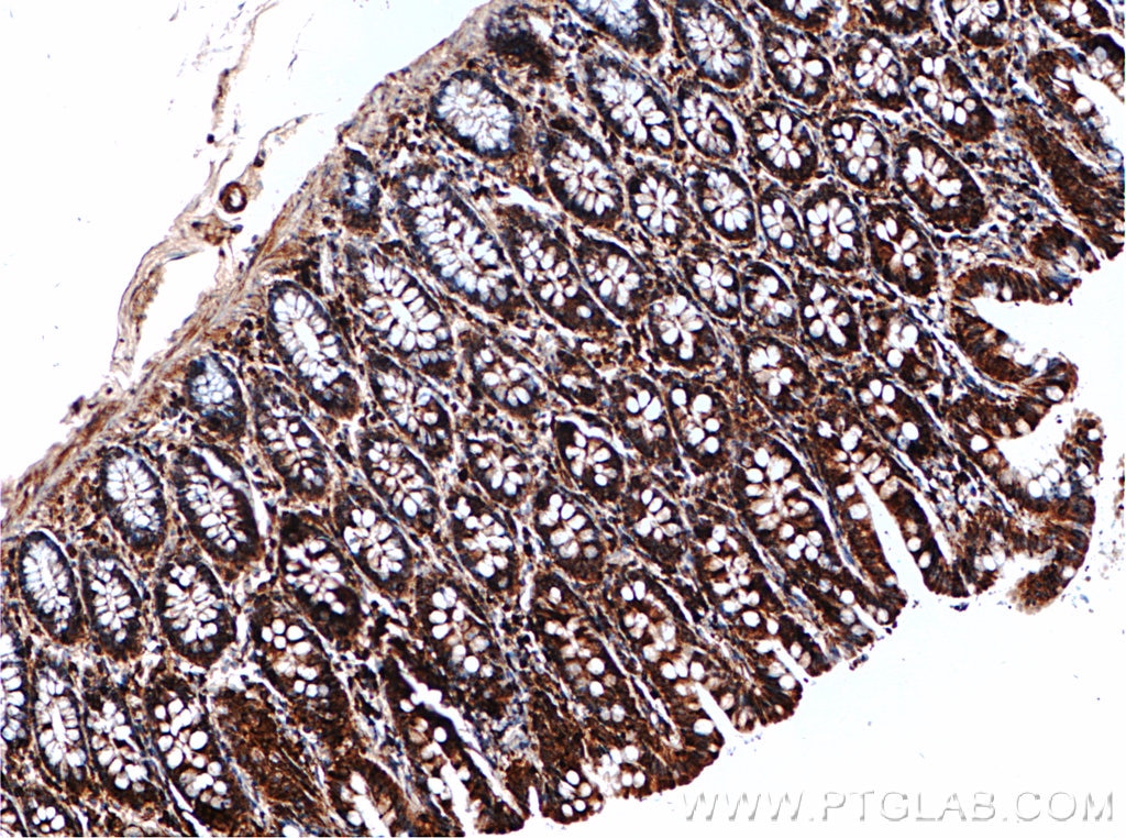 Immunohistochemistry (IHC) staining of human colon tissue using ACTRT3/ARPM1 Polyclonal antibody (27580-1-AP)