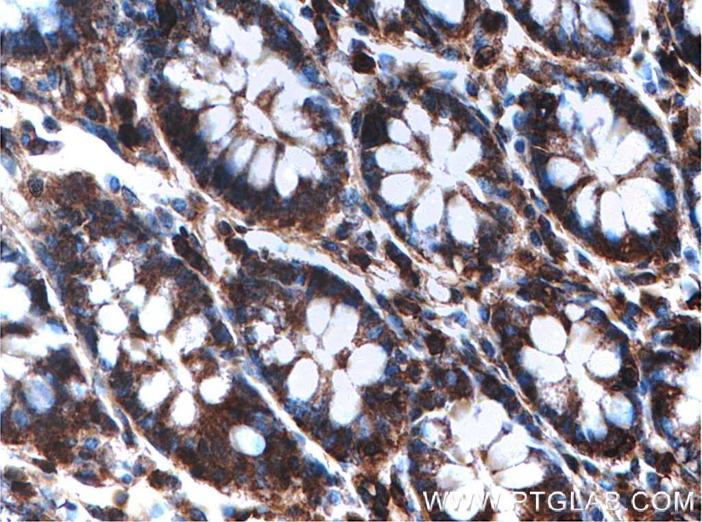 Immunohistochemistry (IHC) staining of human colon tissue using ACTRT3/ARPM1 Polyclonal antibody (27580-1-AP)