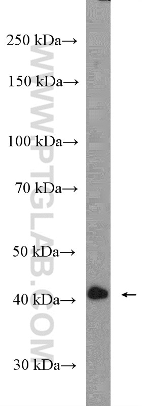 ACTRT3/ARPM1