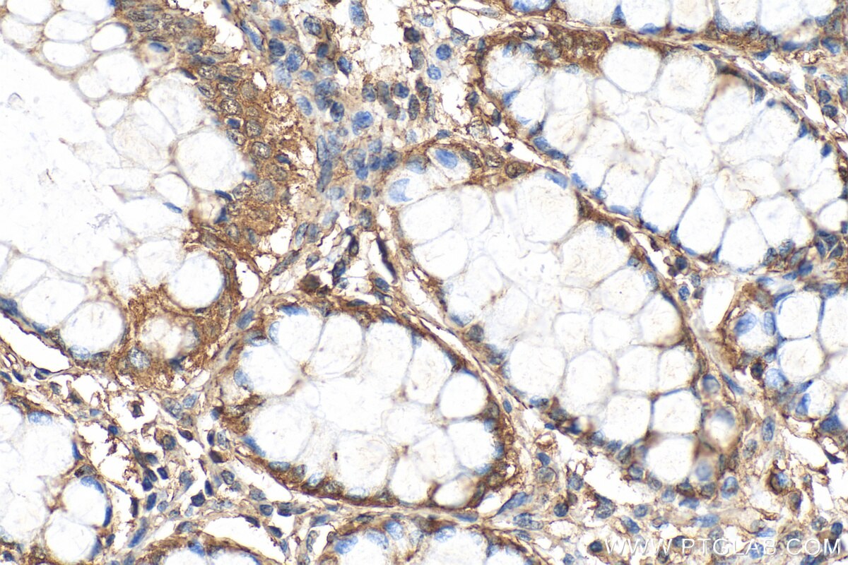 Immunohistochemistry (IHC) staining of human colon tissue using ACTRT3/ARPM1 Monoclonal antibody (68372-1-Ig)