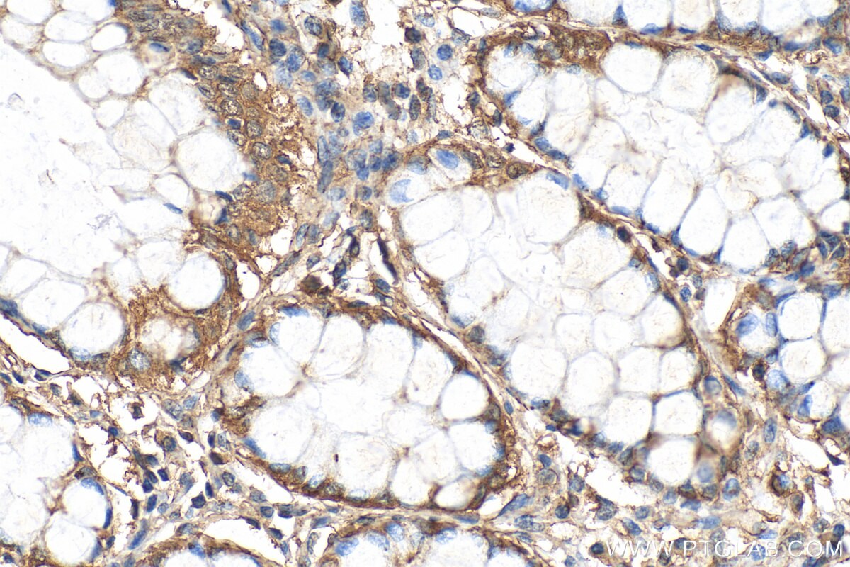 IHC staining of human colon using 68372-1-Ig