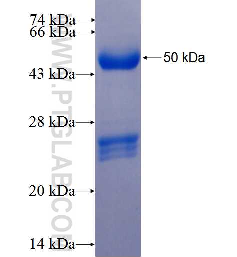 ARPM1 fusion protein Ag25951 SDS-PAGE