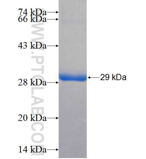 ARPM1 fusion protein Ag25957 SDS-PAGE