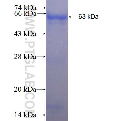 ARPM1 fusion protein Ag1010 SDS-PAGE