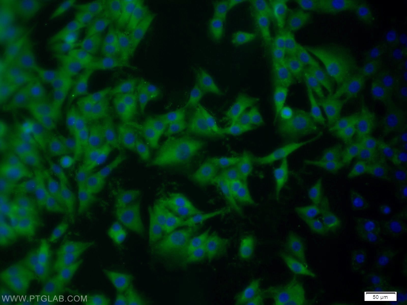 Immunofluorescence (IF) / fluorescent staining of A375 cells using ARPP-19 Polyclonal antibody (11678-1-AP)