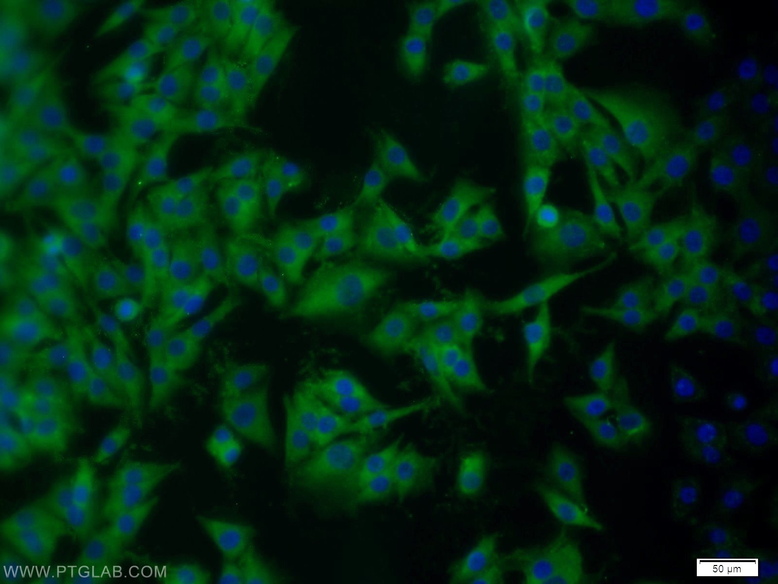 IF Staining of A375 using 11678-1-AP