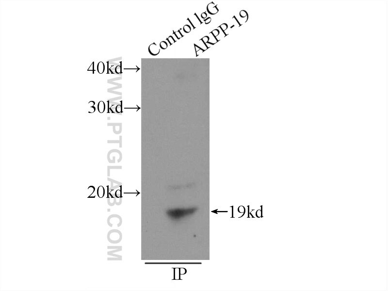 Immunoprecipitation (IP) experiment of mouse brain tissue using ARPP-19 Polyclonal antibody (11678-1-AP)