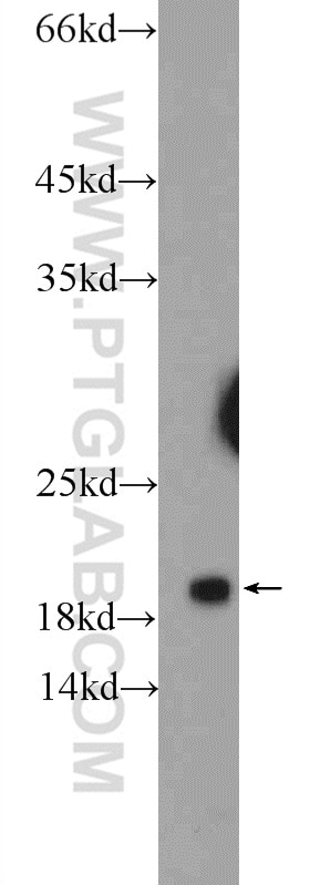 Western Blot (WB) analysis of rat skeletal muscle tissue using ARPP-19 Polyclonal antibody (11678-1-AP)