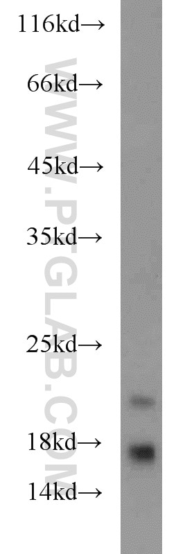 Western Blot (WB) analysis of mouse brain tissue using ARPP-19 Polyclonal antibody (11678-1-AP)