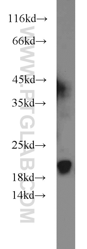 Western Blot (WB) analysis of A375 cells using ARPP-19 Polyclonal antibody (11678-1-AP)