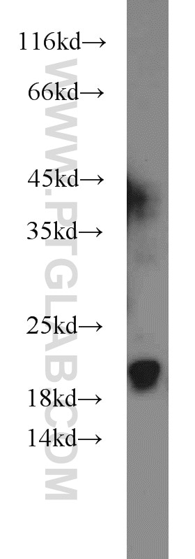 WB analysis of A375 using 11678-1-AP