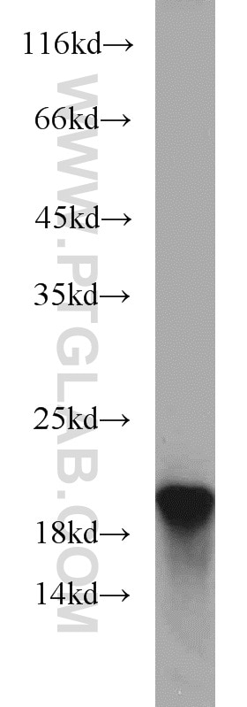 WB analysis of A549 using 11678-1-AP