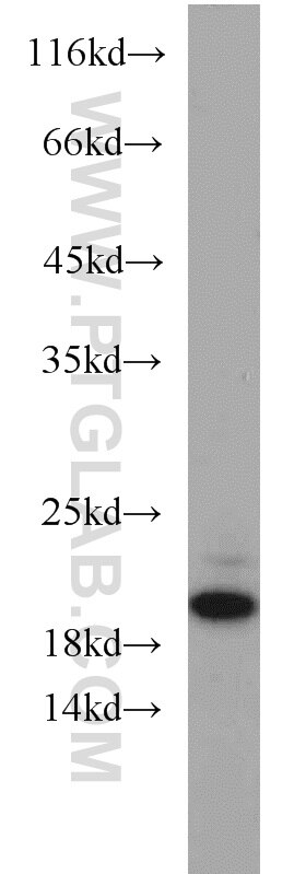 Western Blot (WB) analysis of Jurkat cells using ARPP-19 Polyclonal antibody (11678-1-AP)
