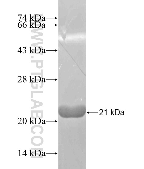 ARPP-19 fusion protein Ag20519 SDS-PAGE