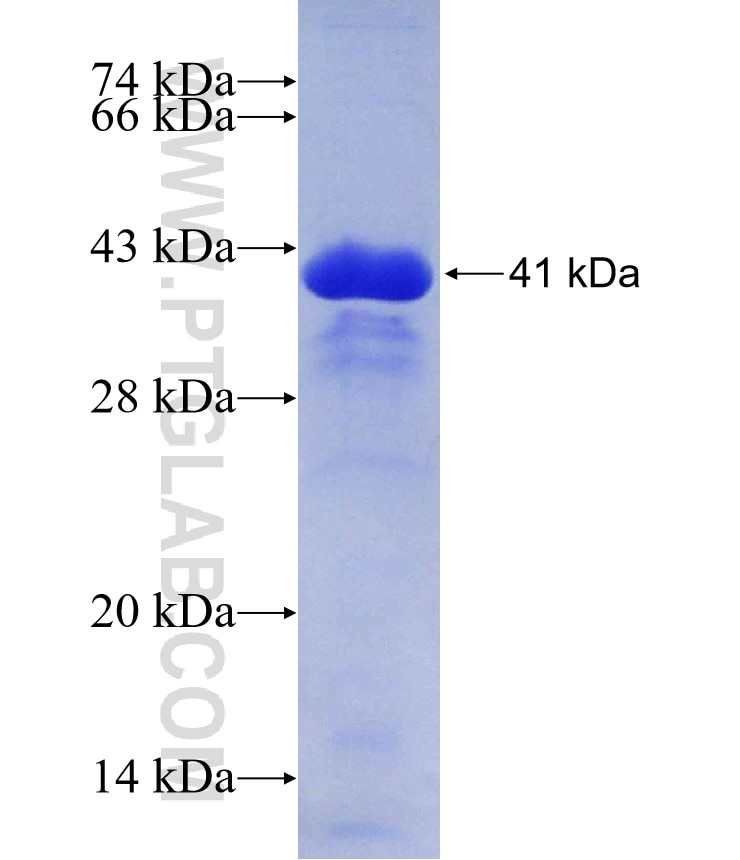 ARPP-19 fusion protein Ag2279 SDS-PAGE