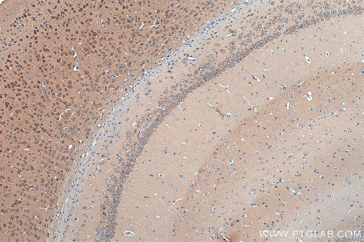 Immunohistochemistry (IHC) staining of mouse brain tissue using ARPP-21 Polyclonal antibody (11829-1-AP)