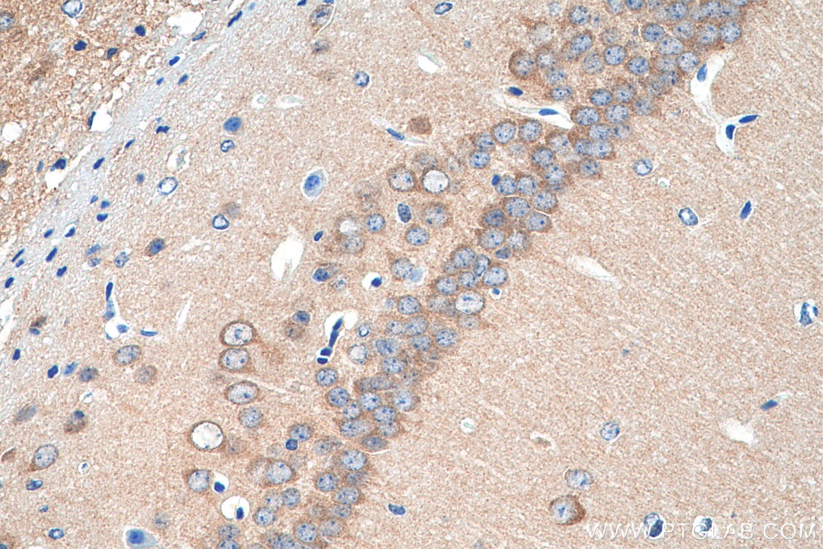 Immunohistochemistry (IHC) staining of mouse brain tissue using ARPP-21 Polyclonal antibody (11829-1-AP)