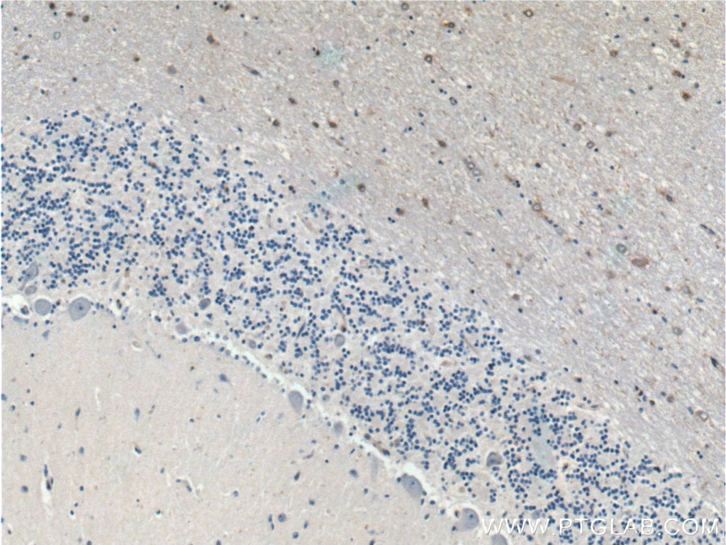 Immunohistochemistry (IHC) staining of human cerebellum tissue using ARPP-21 Polyclonal antibody (11829-1-AP)