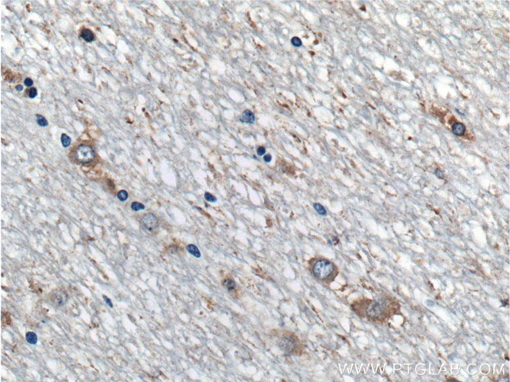 Immunohistochemistry (IHC) staining of human cerebellum tissue using ARPP-21 Polyclonal antibody (11829-1-AP)