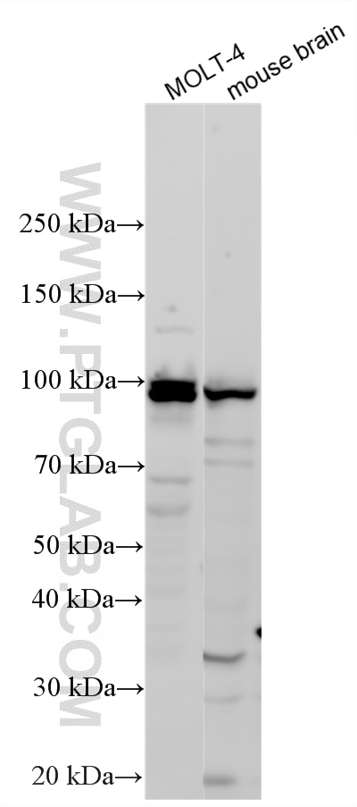 Western Blot (WB) analysis of various lysates using ARPP-21 Polyclonal antibody (11829-1-AP)