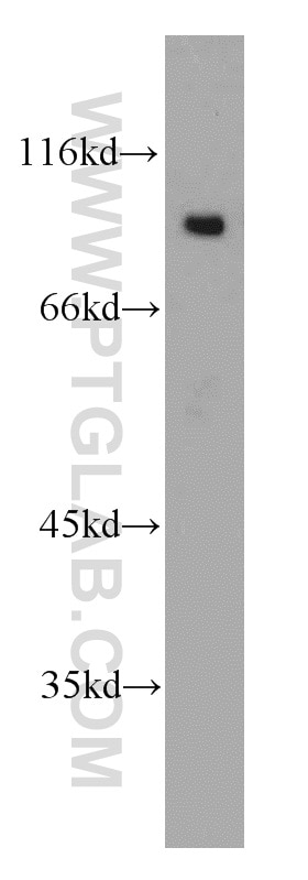 Western Blot (WB) analysis of mouse brain tissue using ARPP-21 Polyclonal antibody (11829-1-AP)