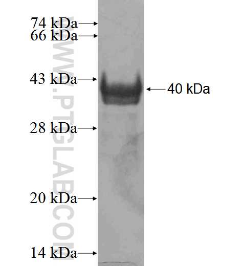 ARPP-21 fusion protein Ag2399 SDS-PAGE