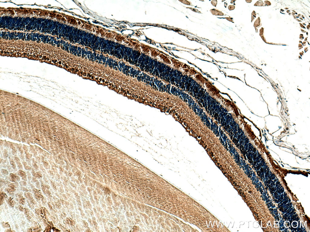 Immunohistochemistry (IHC) staining of mouse eye tissue using Arrestin C Polyclonal antibody (11100-2-AP)