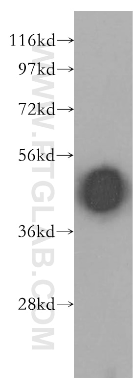 Western Blot (WB) analysis of human brain tissue using Arrestin C Polyclonal antibody (11100-2-AP)