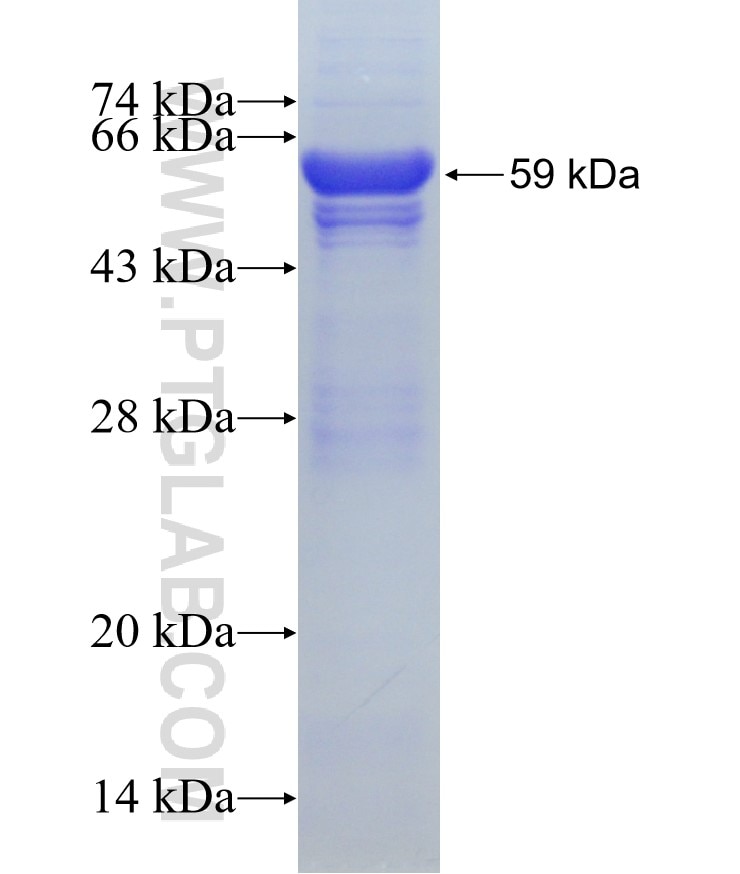 ARR3 fusion protein Ag1580 SDS-PAGE