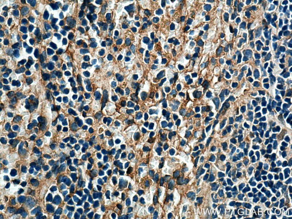 Immunohistochemistry (IHC) staining of mouse spleen tissue using Beta Arrestin 1 Polyclonal antibody (15361-1-AP)