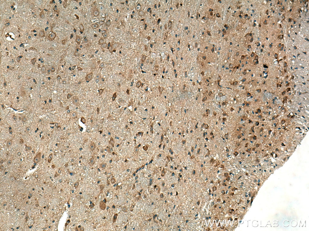 Immunohistochemistry (IHC) staining of mouse cerebellum tissue using Beta Arrestin 1 Polyclonal antibody (15361-1-AP)