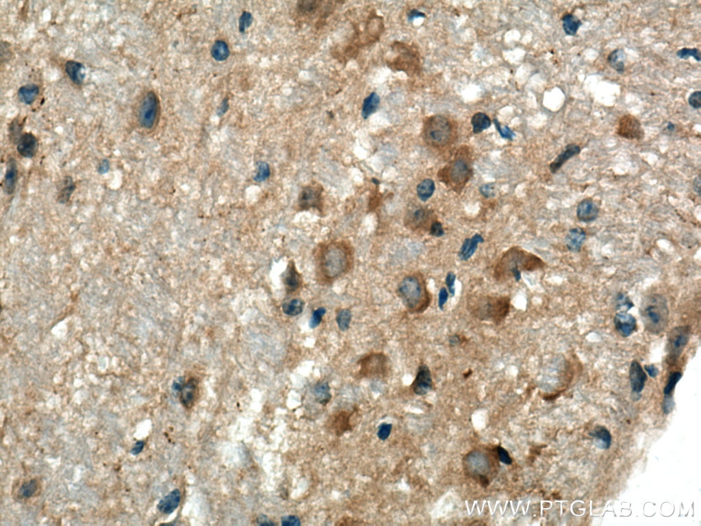 Immunohistochemistry (IHC) staining of mouse cerebellum tissue using Beta Arrestin 1 Polyclonal antibody (15361-1-AP)