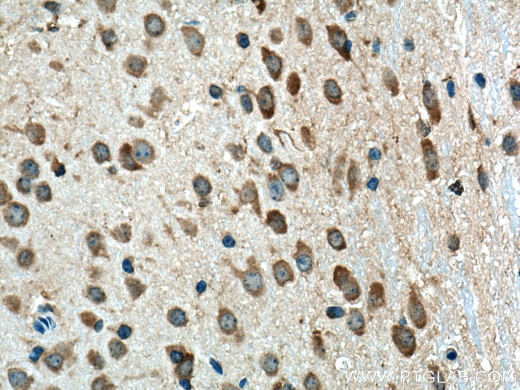 Immunohistochemistry (IHC) staining of mouse brain tissue using Beta Arrestin 1 Polyclonal antibody (15361-1-AP)