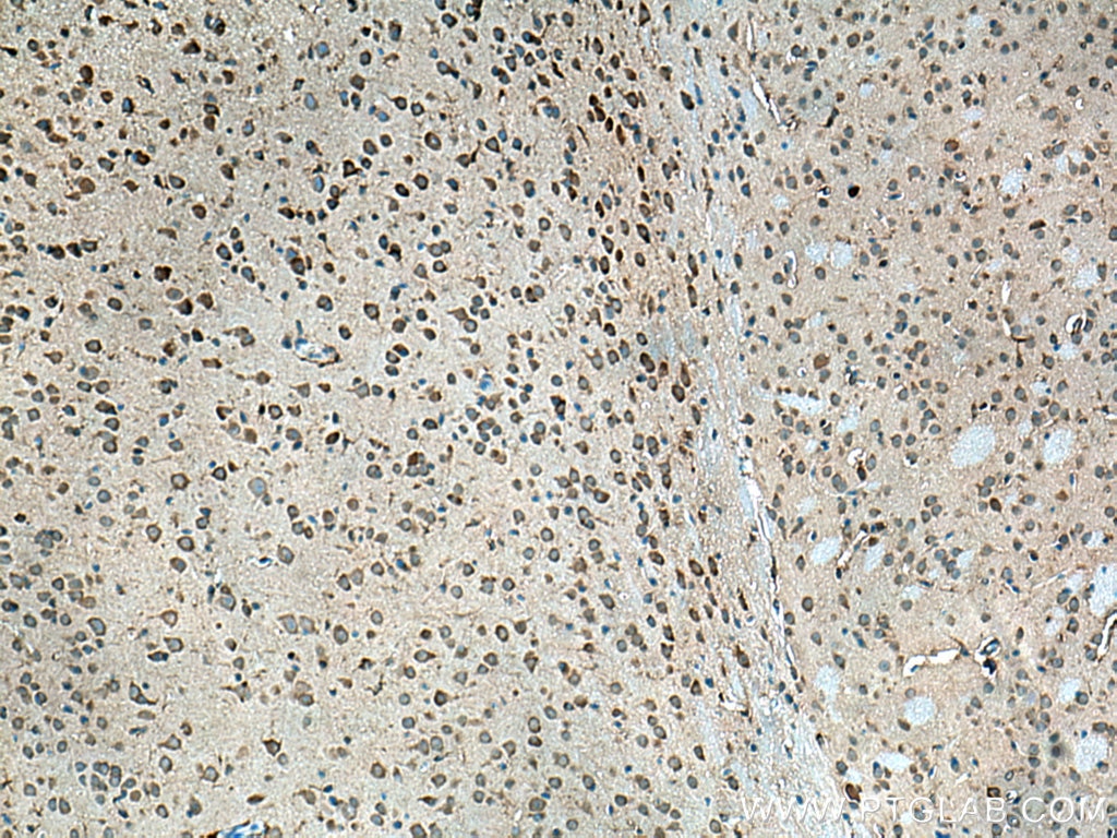 Immunohistochemistry (IHC) staining of mouse brain tissue using Beta Arrestin 1 Polyclonal antibody (15361-1-AP)