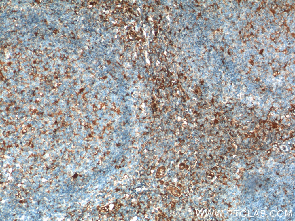 Immunohistochemistry (IHC) staining of human tonsillitis tissue using Beta Arrestin 1 Polyclonal antibody (15361-1-AP)