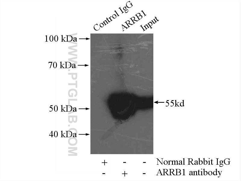 Immunoprecipitation (IP) experiment of mouse lung tissue using Beta Arrestin 1 Polyclonal antibody (15361-1-AP)