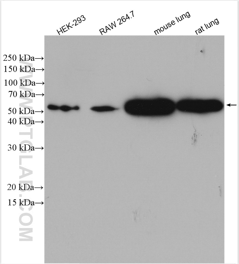 Western Blot (WB) analysis of various lysates using Beta Arrestin 1 Polyclonal antibody (15361-1-AP)